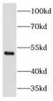 THAP Domain Containing 11 antibody, FNab08660, FineTest, Western Blot image 