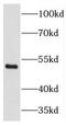 THAP domain-containing protein 11 antibody, FNab08660, FineTest, Western Blot image 