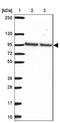 Pseudouridine Synthase 7 Like antibody, NBP2-31630, Novus Biologicals, Western Blot image 