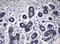 CA-19.9 antibody, LS-C337082, Lifespan Biosciences, Immunohistochemistry paraffin image 