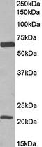 Solute Carrier Family 1 Member 3 antibody, orb79359, Biorbyt, Western Blot image 