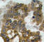 AKT Serine/Threonine Kinase 2 antibody, AP0305, ABclonal Technology, Immunohistochemistry paraffin image 