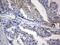 Procollagen-Lysine,2-Oxoglutarate 5-Dioxygenase 2 antibody, LS-C798029, Lifespan Biosciences, Immunohistochemistry frozen image 