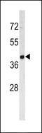 Prp1 antibody, 62-399, ProSci, Western Blot image 