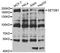 SET Domain Bifurcated Histone Lysine Methyltransferase 1 antibody, MBS2517525, MyBioSource, Western Blot image 