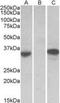 Chymase 1 antibody, NBP2-27551, Novus Biologicals, Western Blot image 