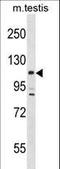 Large Tumor Suppressor Kinase 2 antibody, LS-C157920, Lifespan Biosciences, Western Blot image 