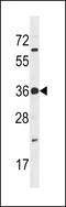 TP53 Regulating Kinase antibody, LS-C101199, Lifespan Biosciences, Western Blot image 