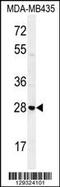 STX19 antibody, 55-876, ProSci, Western Blot image 