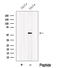 Oxysterol-binding protein-related protein 2 antibody, GTX00814, GeneTex, Western Blot image 