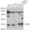 WD Repeat Domain 77 antibody, A04894, Boster Biological Technology, Western Blot image 