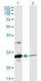 Ubiquitin Conjugating Enzyme E2 T antibody, H00029089-M02, Novus Biologicals, Western Blot image 