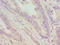 Dentin Matrix Acidic Phosphoprotein 1 antibody, LS-C375597, Lifespan Biosciences, Immunohistochemistry paraffin image 