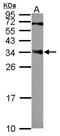 Centromere Protein P antibody, NBP2-15859, Novus Biologicals, Western Blot image 