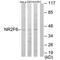 Nuclear Receptor Subfamily 2 Group F Member 6 antibody, PA5-49785, Invitrogen Antibodies, Western Blot image 