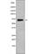 Potassium Voltage-Gated Channel Subfamily D Member 2 antibody, abx216374, Abbexa, Western Blot image 