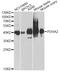 Pyruvate Dehydrogenase E1 Alpha 2 Subunit antibody, A11347, Boster Biological Technology, Western Blot image 