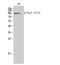 Vav Guanine Nucleotide Exchange Factor 3 antibody, A03204Y173, Boster Biological Technology, Western Blot image 