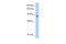 Aconitase 1 antibody, 29-285, ProSci, Enzyme Linked Immunosorbent Assay image 