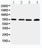 Interleukin 1 Receptor Associated Kinase 2 antibody, LS-C313336, Lifespan Biosciences, Western Blot image 