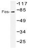 FES Proto-Oncogene, Tyrosine Kinase antibody, AP20518PU-N, Origene, Western Blot image 