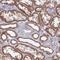 Coiled-coil domain-containing protein 106 antibody, NBP2-30390, Novus Biologicals, Immunohistochemistry paraffin image 