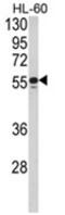 Nuclear Receptor Subfamily 1 Group H Member 2 antibody, AP18141PU-N, Origene, Western Blot image 