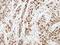Aurora A antibody, PA5-34700, Invitrogen Antibodies, Immunohistochemistry frozen image 