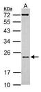 Activation Induced Cytidine Deaminase antibody, GTX104662, GeneTex, Western Blot image 