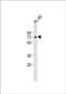 Sphingomyelin Phosphodiesterase 1 antibody, PA5-72432, Invitrogen Antibodies, Western Blot image 