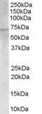 Choline O-Acetyltransferase antibody, 45-038, ProSci, Western Blot image 