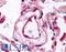 Fms Related Tyrosine Kinase 1 antibody, LS-B668, Lifespan Biosciences, Immunohistochemistry paraffin image 