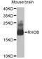 Ras Homolog Family Member B antibody, A2819, ABclonal Technology, Western Blot image 