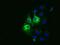 Cytochrome B5 Reductase 3 antibody, GTX84645, GeneTex, Immunofluorescence image 