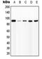 Interferon Gamma Receptor 1 antibody, LS-C352350, Lifespan Biosciences, Western Blot image 