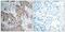 Insulin Like Growth Factor 1 Receptor antibody, PA5-37601, Invitrogen Antibodies, Immunohistochemistry paraffin image 