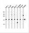 Actin Related Protein 2/3 Complex Subunit 5 antibody, M02096-1, Boster Biological Technology, Western Blot image 