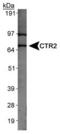 Solute Carrier Family 31 Member 2 antibody, PA5-22961, Invitrogen Antibodies, Western Blot image 