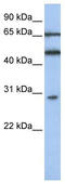 Interferon Induced Protein With Tetratricopeptide Repeats 5 antibody, TA334458, Origene, Western Blot image 