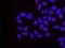 Minichromosome Maintenance Complex Component 4 antibody, NB100-290, Novus Biologicals, Proximity Ligation Assay image 
