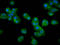 VRK Serine/Threonine Kinase 2 antibody, LS-C681692, Lifespan Biosciences, Immunofluorescence image 