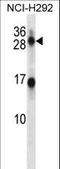 Kallikrein Related Peptidase 14 antibody, LS-C165582, Lifespan Biosciences, Western Blot image 