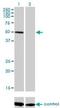 Zinc Finger Protein 277 antibody, H00011179-M01, Novus Biologicals, Western Blot image 