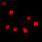 RNA Binding Motif Protein X-Linked antibody, LS-C358272, Lifespan Biosciences, Immunofluorescence image 