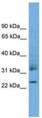 Ras Homolog Family Member J antibody, TA344772, Origene, Western Blot image 