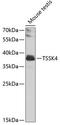 Testis Specific Serine Kinase 4 antibody, GTX55823, GeneTex, Western Blot image 