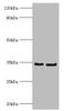 Rabies virus Phosphoprotein antibody, A54523-100, Epigentek, Western Blot image 