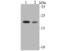 Catechol-O-Methyltransferase antibody, NBP2-75444, Novus Biologicals, Western Blot image 