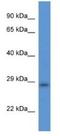 Transmembrane Protein 33 antibody, NBP1-74217, Novus Biologicals, Western Blot image 