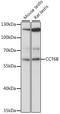 Chaperonin Containing TCP1 Subunit 6B antibody, A12335, Boster Biological Technology, Western Blot image 
